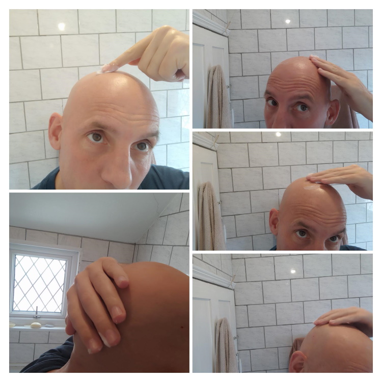 collage of applying Zero Shine by dermimatch matte bald head cream