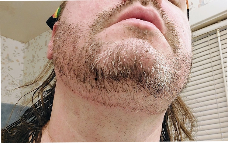 showing the red line left after using the Aberlite Flexshaper 2.0 on the neck