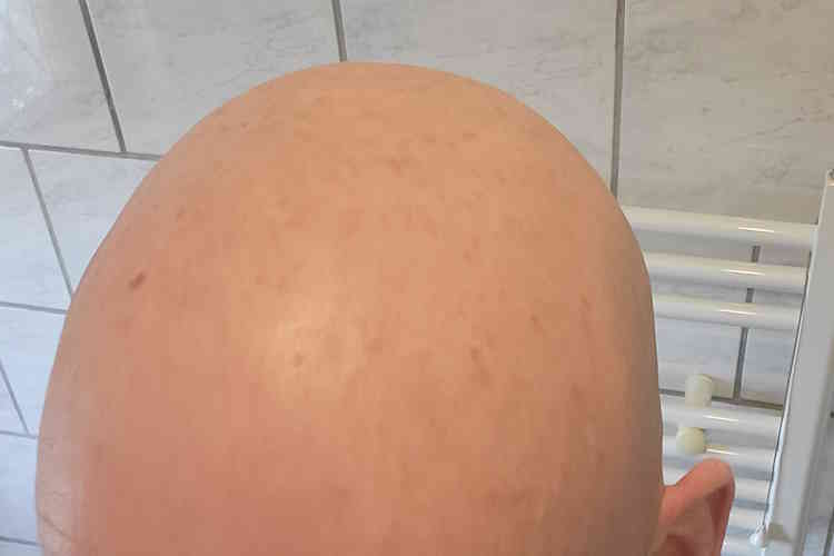 bald head after using Headblade HeadLube matte lotion