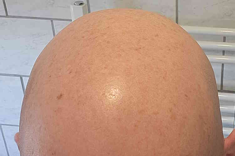 bald head before using Headblade HeadLube matte lotion