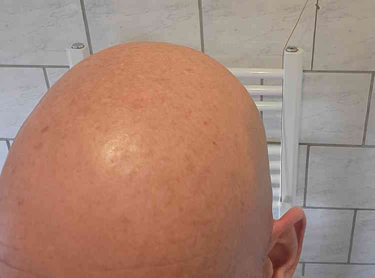 bald head after using Bee Bald Smooth Daily Moisturizer