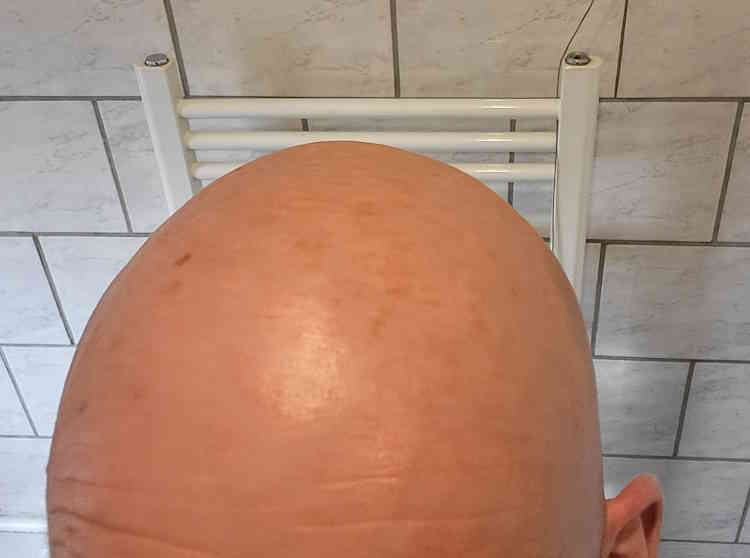 bald head before using Bee Bald Smooth Daily Moisturizer