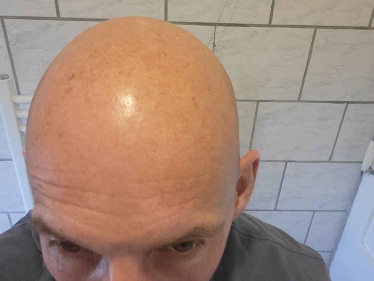 bald head after applying Bald Boss Face & Scalp Moisturiser