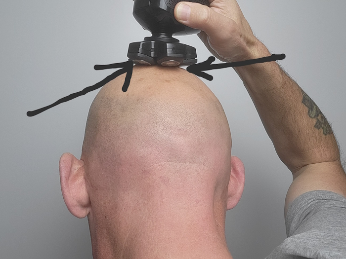 head shaving with Bald Express with arrows pointing to blade overlaps